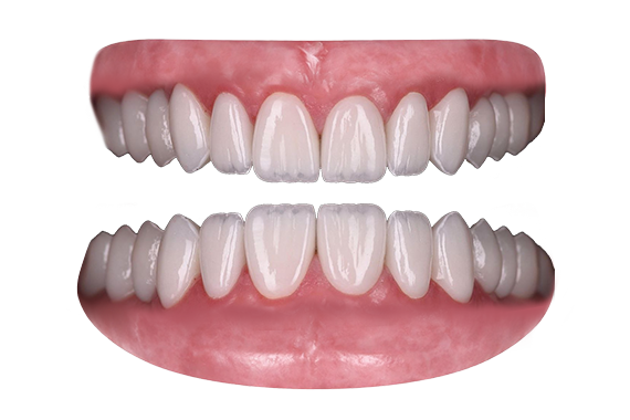 Kõrgesteetilised laminaadid.