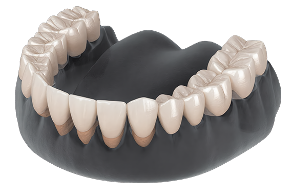 Kõrgesteetilised laminaadid.