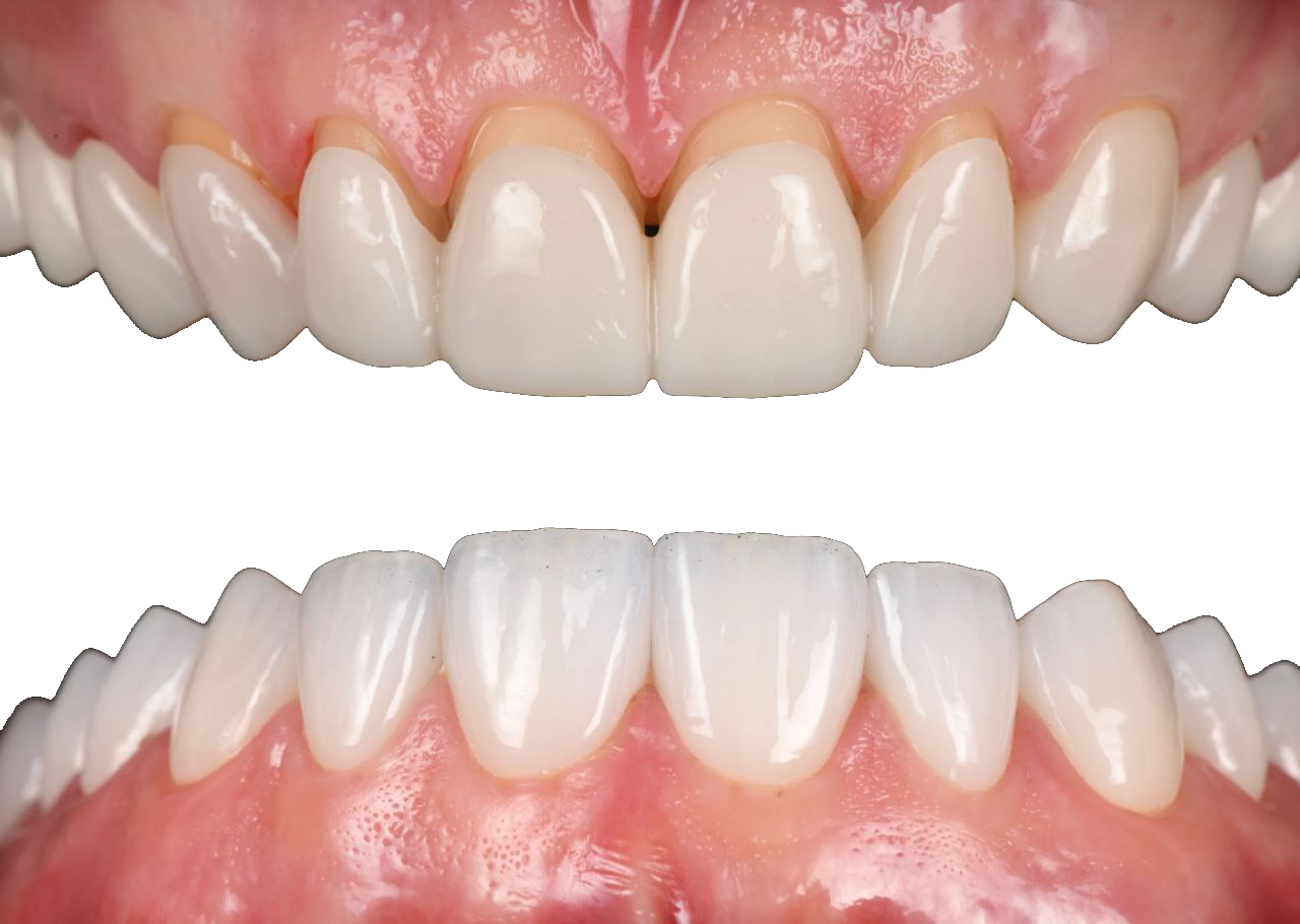 Kõrgesteetilised laminaadid.